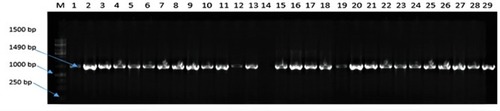 Figure 1 Agarose gel (1%) electrophoresis showing the amplification of 16 S rDNA of representative presumptive bacteria isolates colonising the gut of chickens obtained from North-west province, South Africa.Notes: Lane 1 to 29 shows the amplification of 16 S region of presumptive Salmonella DNA isolates while lanes 14 = no template (negative control), lane 13 = Salmonella Typhimurium ATCC 14028 (positive control).Abbreviations: M, DNA marker (1kb); bp, base pairs.