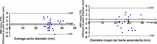 Figure 1. A. Bland‐Attman plot of the aortic diameters at the level of aortic sinuses measured by MRI versus TTE. B. Bland‐Attman plot of the aortic diameters at the level of ascending aorta measured by MRI versus TTE. (View this art in color at www.dekker.com.)