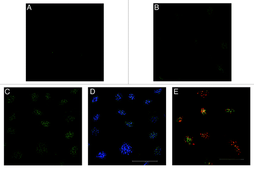 Figure 8. Nuclear localization of 5-hmC (green punctuation) after 1% DMSO treatment in MC3T3-E1 cells. The increase in 5-hmC was demonstrated and localized by immune-staining techniques. When compared with control (A), an increase in 5-hmC was already visible after 12 h of 1% DMSO treatment (B) and after 1 d (C) the effect was clearly more pronounced. Combined staining with DAPI demonstrated the signals of 5-hmCs in the nuclei and revealed that most of the hydroxymethylated spots were found outside of the heterochromatic regions (D). Co-labeling of DMSO treated cells with 5-mC (red spots) and 5-hmC (green spots) antibodies revealed areas where only 5-hmCs or 5-mCs are localized. However, also double-labeled regions were found (yellow spots, E). Scale bar for all images is 50 µm.