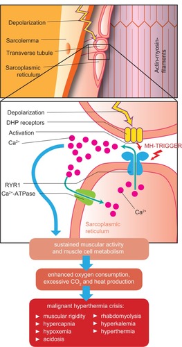 Figure 1 Pathophysiologic changes during a malignant hyperthermia crisis.