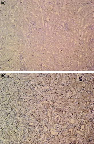 Figure 2.  2a: Light and diffuse immunostaining for iNOS in kidney of a control goose, ×185. 2b: Moderate immunostaining for iNOS on renal tubular epithelium in an EG-intoxicated goose, ×185.