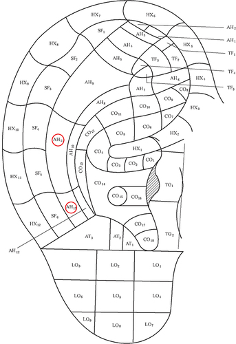 Figure 2 Locations of auricular acupoints (red circles).