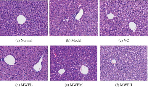 Figure 1. Representative photomicrographs of liver sections from each group of mice stained with hematoxylin and eosin (H&E) (observation under an optical microscope (200×)). (A) NC group: the structure of the liver cells was intact, and the structure of the hepatic cords was clear. (B) Model group: the volume of the liver cells decreased; some individual cells were pyknotic and spottily necrotic. (C) VC group: the structure of the liver cells was basically intact. (D) MWEL group: the structure of the liver cells was relatively intact; the volumes of a small number of liver cells decreased, and some individual liver cells were necrotic. (E) MWEM group: the structure of the liver cells was relatively intact; no significant injury occurred to the liver cells. (F) MWEH group: the structure of the liver cells was intact and in an orderly arrangement, similar to that of the liver cells in the NC group. NC, normal control; Model, restraint stress model; VC, restraint-stressed mice treated with vitamin C 250 mg/kg bw; MWEL, restraint-stressed mice treated with M. charantia water extract 250 mg/kg bw; MWEM, restraint-stressed mice treated with M. charantia water extract 500 mg/kg bw; MWEH, restraint-stressed mice treated with M. charantia water extract 750 mg/kg bw.