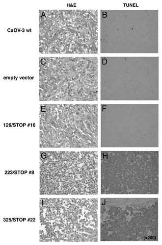 Figure 5. Evidence for apoptosis. After 24 h of serum starvation, various truncated IGF-IR transfected clones, wild-type CaOV-3 cells and an empty vector transfected clone were inoculated s.c. in nude mice. After 72 h inoculation, formed tumors were excised and stained with H&E or TUNEL.