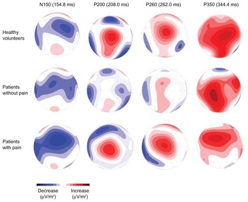 Figure 3 Group-specific topographic representations. Shown are the topographic representations of the different event-related potential (ERP) components at the different ERP latencies (Figure 2).