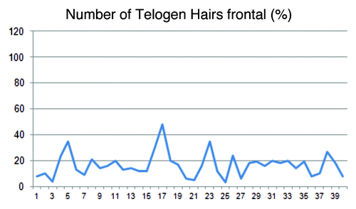 Figure 4. The percentage of the telogen hairs in the frontal region of the head varied from 4–48% (mean 16.5).