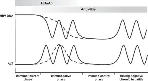 Figure 1 The natural of history of chronic hepatitis B virus infection.Abbreviations: HBV, chronic hepatitis B virus; HBeAg, hepatitis B e antigen; ALT, alanine aminotransferase.