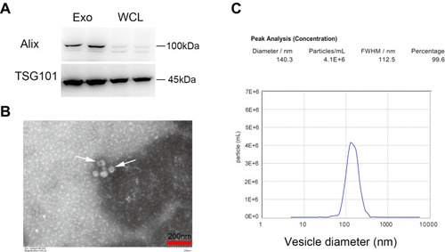 Figure 1 Exosomes isolation and characterization. (A) Western blot analysis of Alix and TSG101, Whole cell lysates (WCL) of MIN6 cells were loaded as controls. (B) Representative TEM image. Arrowheads indicate exosomes. Scale bar =200 nm. (C) Size distribution detection by NTA.