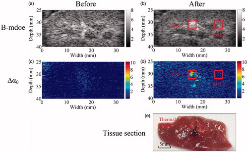 Figure 5. Ultrasonic B-mode, Δα0 and tissue section images of the thermal lesion in an in vivo porcine kidney immediately after MWA. Regions of interest are 3 × 3 mm.