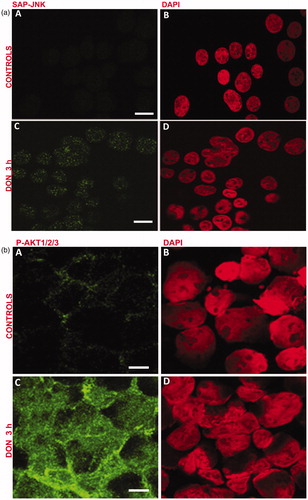 Figure 3. DON treatment results in phosphorylation of JNK 1/2 and AKT. (a) Jurkat cells were treated with 0.5 μM DON for 3 h. (A, B) untreated; (C, D) treated. (A, C) Phospho-SAP/JNK staining; (B, D) DNA staining with DAPI. Scale bar: 7 μm. (b) Cells were treated with 0.5 μM DON for 3 h. (A, B) untreated; (C, D) treated. (A, C) Phospho-AKT1/2/3 staining; (B, D) DNA staining with DAPI. Scale bar: 11 μm (untreated) and 14 μm (DON-treated).