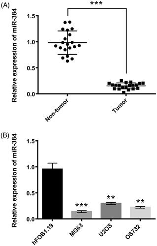 Figure 1. miR-384 was down-regulated in (A) clinical human osteosarcoma tissues and (B) osteosarcoma cell lines. miR-384 was quantified using qRT-PCR. Means ± SD were shown. **p < .01, ***p < .001.