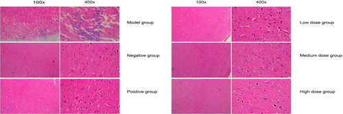 Figure 10 Histopathology of the brain tissues with H&E staining.