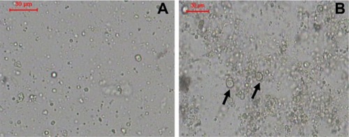Figure 1 (A and B) Optical photomicrographs of liposomes. (A) F1, prepared by lipid hydration method and (B) F2, prepared by heating method.Notes: Bar = 30 μm. Arrows point to multilamellar vesicles.