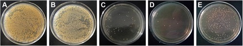 Figure 9 Staphylococcus aureus colonies collected from the cp-Ti (A), TNT (B), Ti1%Ag-NT (C), Ti2%Ag-NT (D), and Ti4%Ag-NT (E) samples.Abbreviations: cp-Ti, commercial pure titanium; TNT, titania nanotubes; TiAg-NT, TiAg alloys with nanotubular coverings.
