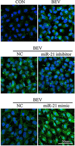 Figure 7 The effect of miR-21 inhibitor and miR-21 mimic on SNAI1 expression in ARPE-19 cells: BEV treatment can increase the expression of SNAI1 in ARPE-19 cells, while miR-21 inhibitor can inhibit the expression of SNAI1. The miR-21 mimic enhanced the increase in SNAI1 production caused by BEV.