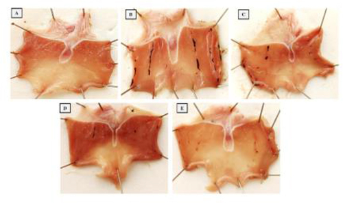 Figure 7 Rat stomach macrophotographs are shown. (A) No lesions or redness were visible on the stomach mucosa in the control group. (B) Rats administered with Indo showed a mucous surface ulceration that was severely bleeding. Surface injuries in (C) Indo + DMQ (30 mg/kg) are visible. (D) Indo + DMQ (30 mg/kg) demonstrates little damage with healthy mucosa. (E) The mucosal layer that is injured is efficiently restored to normal with Indo + esomeprazole; there is no redness or damage visible. The information is displayed as mean ± SD. Significant differences were found between the groups as follows: a) with the control group, b) with Indo (p < 0.05), and c) with Indo + DMQ (10mg/kg) (p < 0.05).