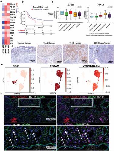 Figure 1. B7-H4 is expressed by bladder cancer and myeloid cells in human and murine bladder cancer. (a) Heat map of mRNAs of immune regulatory genes at 1, 2 and 4 weeks of BBN exposure. (b) Overall survival of the muscle invasive bladder cancers (MIBC) from the TCGA identifying worse survival for patients with high levels of VTCN1 (B7-H4). (c) Muscle invasive bladder cancers (MIBC, Stage II or greater) can be grouped by intrinsic tumor subtype. We performed subtype analysis of MIBCs from the TCGA and grouped them by subptype. In contrast to tumor subtype (like basal tumors) that express high levels of other immune regulatory proteins, like PD-L1, B7-H4 is more highly expressed in luminal and luminal-infiltrated tumors, (d) Immunohistochemistry of B7-H4 in normal human bladder, low grade noninvasive (stage TaLG), and invasive (Stage T1HG) demonstrating expression on tumor and infiltrating leuckocytes and in BBN mouse bladder tumor demonstrating expression only on infiltrating leukocytes (20X magnification). These localizations in human bladder cancer were confirmed by single-cell RNA-seq of a low-grade Ta tumor (e) showing high expression in luminal cells (EPCAM+) and scattered expression in myeloid cells (CD68+). Imaging mass cytometry applied to FFPE NMIBC section showing expression of B7H4 (white), smooth muscle actin (green) and pan-keratin (red). B7H4 was localized to the tumor stromal region (pan-keratin negative) (left). Same image as in (left) with the addition of CD68 (magenta) showing colocalization of B7H4 with a subset of CD68+ myeloid cells (right). Enlarged image of the indicated region in (left) with box. Enlarged image of indicated region from the right