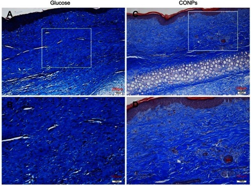 Figure 3 Masson trichrome staining. Masson trichrome staining was used for the evaluation of collagen fiber organization. Collagen fibers were dense and disorderly in the control scars (A, B), and significantly improved in cuprous oxide nanoparticles (CONPs)-treated scars (C, D).