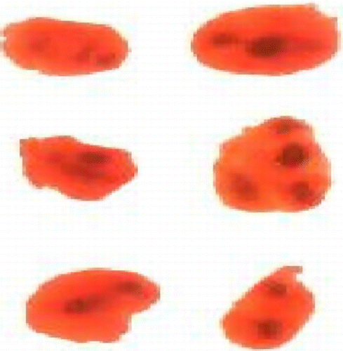 Figure 1.  Silver-stained NORs pattern in thymocyte nuclei. Different sizes of nuclei were observed and stained pale red whereas silver stained NORs appeared as small black and dark brown intra nuclear dots in tissues from garlic-treated rats. Nuclei contain more than one dot (magnification = 1200×).