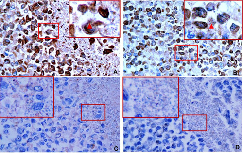 Figure 9 The expression of CD86, CD163 and CD1a on M1 macrophages were detected by immunohistochemistry after co-culturing with T. marneffei conidia for 24 hours. Macrophages and T. marneffei were CD86 positive (A and B) but CD163 (C) and CD1a (D) negative detected by immunohistochemistry. CD86-positive T. marneffei conidia were indicated by the red arrows. Hematoxylin and eosin (H&E) ×400.