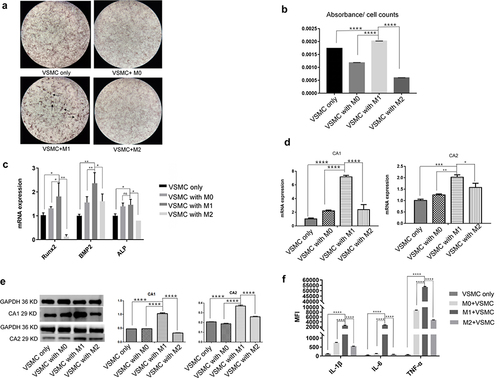 Figure 3 The effect of macrophage supernatants on VSMC calcification. VSMCs were separately cultured with the supernatant of M0, M1 or M2 macrophages and calcification-inducing medium (1:1 proportions) (ANOVA, *Stands for p<0.05, **Stands for p<0.01, ***Stands for p <0.001, and ****Stands for p <0.0001). (a) Alizarin red staining of VSMCs cocultured with supernatants from the different macrophages (the location of calcification nodules was marked with black arrows). (b) Cetylpyridinium chloride assays quantitated calcification levels in VSMCs cocultured with supernatants from the different macrophage subtypes. (c) The mRNA expression of calcification-related genes, including BMP2, ALP and Runx2, in VSMCs was examined by real-time PCR. (d) The mRNA expression of CA1 and CA2 in VSMCs was examined by real-time PCR. (e) CA1 and CA2 protein expression in VSMCs was examined by Western blot analysis. (f) The levels of IL-1β, IL-6 and TNF-α in the culture medium of VSMCs that were cultured with macrophage supernatant were examined by flow cytometry. M1 culture supernatant stimulated calcification, increased CA1 and CA2 expression in VSMCs, and elevated IL-1β, IL-6 and TNF-α levels in the cocultures.