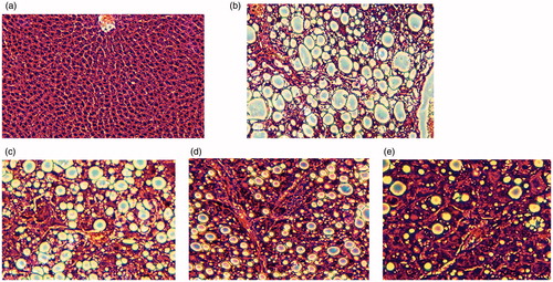 Figure 5. HE staining results of pathological sections of rat liver after treatment (100×). A: Control group; B: Model group; C: MSC group; D: Ad-KGF group; E: KGF/MSC group.