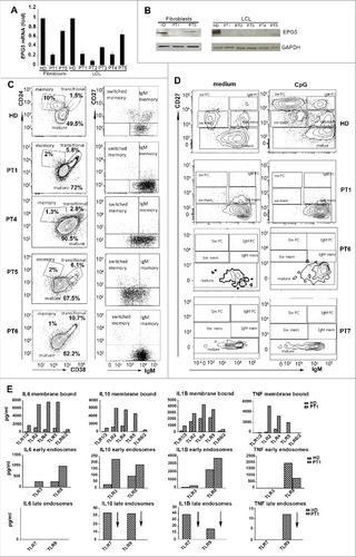 Figure 1. mRNA, protein and immunological study of EPG5. (A) EPG5 mRNA level in fibroblasts and LCL of healthy donor (HD) and patients (PT). Error bars are shown as SEM. (B) EPG5 protein in healthy donor and patients (fibroblasts of PT1 and PT5; LCL of indicated patients). GAPDH was used as a loading control. (C) Dot plots show mature, memory and transitional B cells. Memory B cells can be divided in IgM and switched. For HD a representative plot of B cells (gated for CD19) of a 4-y-old child is shown. In HD the frequency of memory B cells was 14.5±4.49 at 4 y of age (calculated on 20 HD) and 14.9±4.28 at 11 y (calculated on 20 HD). (D) Staining with CD27 and IgM identifies IgM memory B cells (IgM+ CD27+, indicated as IgM mem) and switched memory B cells (IgM- CD27+, indicated as Sw mem). Plasma cells have higher levels of CD27 (CD27++) and express either IgM (IgM PC) or switched isotypes (Sw PC). CD27- IgM+ cells are mature naïve B cells. (E) Level of secreted cytokines in cell medium after stimulation of TLRs (membrane bound, EE and LE) in HD and PT1 PBMCs.