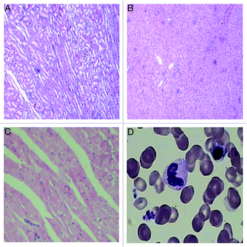 Figure 7. HE staining of important organs and Wright–Giemsa staining of bone marrow in nude mice. (A) HE staining of kidney; (B) HE staining of liver; (C) HE staining of heart; (D) HE staining of bone marrow (100×).