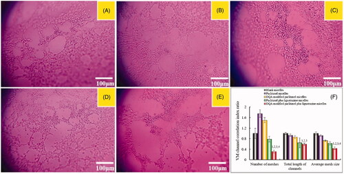 Figure 4. Destructive effects on VM channels in vitro after incubation with the varying formulations. Notes: a. Blank micelles; b. Paclitaxel micelles; c. DQA modified paclitaxel micelles; d. Paclitaxel plus ligustrazine micelles; e. DQA modified paclitaxel plus ligustrazine micelles; f. VM channel correlation index ratio. p < .05, 1 vs a, 2 vs b, 3 vs c, 4 vs d.