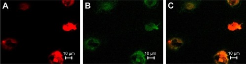 Figure 2 Double-positive cells stained with Dil-acLDL and FITC-UEA1 were identified as endothelial progenitor cells.