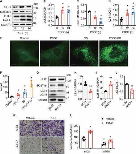 Figure 2. Gene silencing of ULK1 inhibits vascular smooth muscle cell migration in response to PDGF. (A-D) Human aortic smooth muscle cells (HASMCs) were treated with PDGF (platelet-derived growth factor BB, 20 ng/ml) for 12 and 24 h, and protein levels of ULK1, SQSTM1, and LC3 were measured by western blot and densitometry, *P< 0.05, n = 3–4. (E-F) GFP-LC3-expressing HASMCs were treated with PDGF, chloroquine (CQ, 3 µM), or PDGF + CQ for 24 h. (E), Representative images of GFP-LC3 staining. Scale bar: 20 µm. (F) Quantitation of autophagic vacuoles (AV) per cell. n = 3–4, *P< 0.05 vs. Ctrl (control); #P< 0.05 vs. PDGF or CQ. (G-J) Western blot analysis of ULK1, SQSTM1, and LC3 in HASMCs transfected with siCtrl (control siRNA) or siULK1 (ULK1 siRNA). n = 3–4, **P< 0.01, vs. siCtrl. (K-L) HASMCs were transfected with siCtrl or siULK1 for 48 h and treated with PDGF (20 ng/ml) for 24 h. (K) Cell migration was determined by transwell migration assays. Scale bar: 20 µm. (L) Migrated cells were quantified. n = 3–4, *P< 0.05 vs. siCtrl. #P< 0.05 vs. PDGF/siCtrl