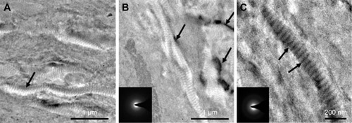 Figure 2 TEM and SAED characterization of NMC, TMC, and BMC scaffolds.Notes: (A) Image of NMC scaffolds stained by uranyl acetate; the arrow shows distinctive cross-band of collagen fibrils without mineralization. (B) Image of TMC scaffolds unstained; the arrows show the apatite crystals located outside of the fibrils of TMC scaffold. The lower left illustration (SAED) shows obvious ring pattern characteristic of crystal structure. (C) Image of BMC scaffolds without staining; the arrows show HA nanocrystals deposit inside and nearby the gap zones, which make the cross-band quite clear. The lower left illustration (SAED) indicates that the main composition is amorphous phase.Abbreviations: BMC, biomimetic mineralized collagen; NMC, non-mineralized collagen; TMC, traditional mineralized collagen; HA, hydroxyapatite; SAED, selected-area electron diffraction; TEM, transmission electron microscopy.