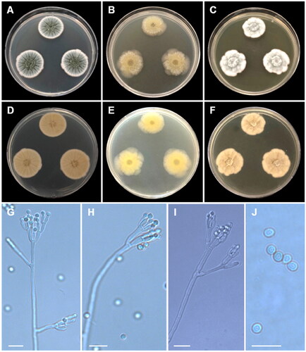 Figure 9. Morphology of Penicillium nalgiovense CNUFC CY224. (A, D) Colonies on Czapek yeast autolysate agar (CYA); (B, E) malt extract agar (MEA); (C, F) yeast extract sucrose agar (YES) (A–C: obverse view and D–F: reverse view); (G–I) Conidiophores; (J) Conidia. Scale bars = 10 µm.