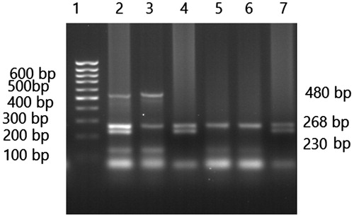 Figure 1. Agarose gel electrophoresis (2%) pattern of GSTM1 and GSTT1 multiplex PCR. From left to right lane 1 shows 100 base pairs DNA molecular weight marker; GSTT1 yields a product of 480 bp, whereas the amplification product of GSTM1 is 230 bp and β-globin gene (268 bp) as an internal control. Lanes 2 GSTT1/GSTM1 genotypes, lanes 3 GSTT1/GSTM1null genotypes, lanes 4 and 7 GSTT1null/GSTM1 genotypes, lanes 5, and 6 GSTT1null/GSTM1null genotypes.
