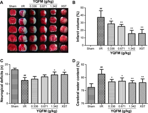 Figure 2 Effects of YQFM on brain injury in mice with cerebral I/R.
