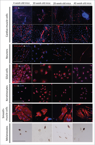 Figure 3. The differentiation potential to various cell types from whisker follicles from mice of different ages. Immunofluorescence staining showed that whisker follicle HAP stemcells from 4-, 10-, 20-, and 40-week-old mice differentiated to cardiac muscle cells, neurons, glial cells, keratinocytes and smooth muscle cells. Red = cTnT, tubulin, GFAP, Keratin 15 (K15) and smooth muscle actin (SMA). Blue = DAPI. Bar = 100 µm. Phase-contrast images showed that HAP stem cell from 4-, 10-, 20-, and 40-week-old mice also differentiated to melanocytes. Bar = 100 µm.
