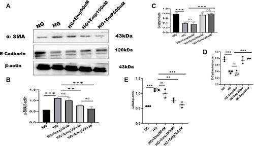 Figure 5 Effect of empagliflozin on the expression of proteins related to EMT in HK-2 cell line. HK-2 cells were planted in 5.5mM glucose and 25mM glucose with or without empagliflozin treatment under normoxia for 72 h. (A) Western blotting was performed using anti-α-SMA, anti-E-cadherin, and anti-β-actin antibodies. β-actin used as a loading control. (B-C) Quantification of Western blot data. (D–E) Individual measurements represented as dot plots. The data represent the mean ± SD of three independent experiments., **P < 0.01, ***P < 0.001, vs. high glucose.Abbreviation: ns, non-significant.