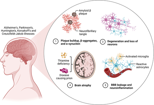 Figure 1 An illustration of a degenerative disease of the brain as a result of gradual neuronal cell damage. Created with BioRender.com.