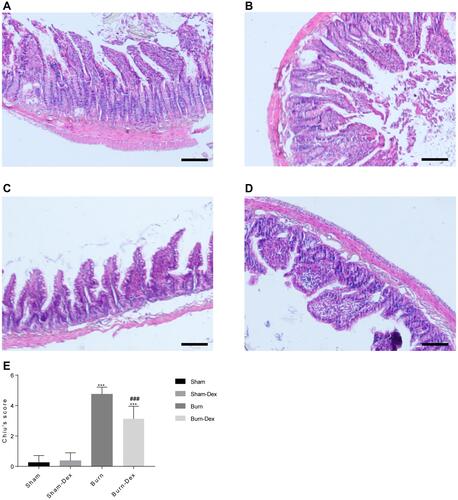 Figure 1 Histological examination of distal ileum. (A) Sham group. (B) Sham-Dex group. (C) Burn group. (D) Burn-Dex group. (E) Intestinal Chiu’s score of each group. ***P < 0.001, vs Sham group. ###P < 0.001, vs Burn group. Scale bar = 100μm.