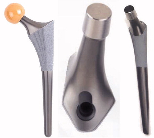 Figure 1. Design features of Symax hip stem, illustrating the anatomically anteverted proximal geometry, with the BONIT-HA coating; and the straight distal part with the DOTIZE surface treatment and a posterior chamfer.