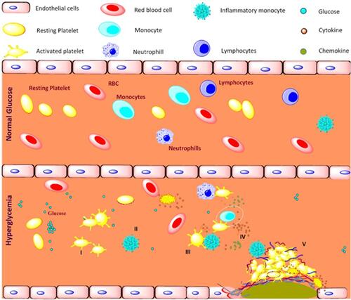 Figure 9 Schematic representation of platelet mediated inflammation process in type 2 diabetes and coronary artery diseases associated with type 2 diabetes. Long term exposure to the hyperglycemia condition and metabolic disturbance, I) activates platelets and II) shift monocytes towards inflammatory phenotypes, III) activated platelets aggregates with immune cells mainly monocytes, IV) triggers the release of pro-inflammatory, anti-inflammatory cytokines and chemokines, V) together contributes to development of atherosclerotic coronary artery diseases in type 2 diabetic patients.