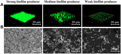 Figure 4 Observation of representative strong, medium, and weak biofilm producers via confocal laser scanning microscopy (CLSM, (A) and field emission scanning electron microscopy (FESEM, (B). scale bars represent 20 μm for CLSM and 10 μm for FESEM.