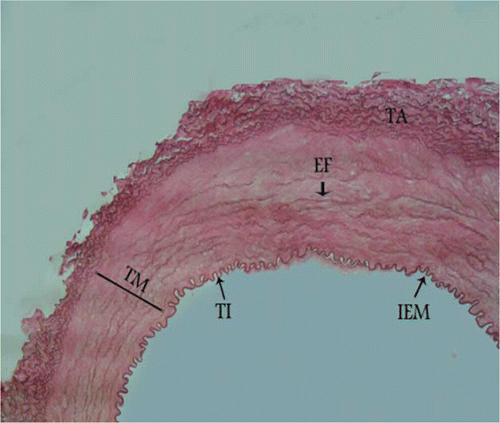 Figure 3.  Photomicrograph – transitional zone in the middle part of canine external carotid artery with more rows of smooth muscle cells and fewer layers of elastic fibres. TI, tunica intima; TM, tunica media; TA, tunica adventitia; IEM, internal elastic membrane; EF, elastic fibres. Orcein stain, 280×, Bar = 35.7 µm.