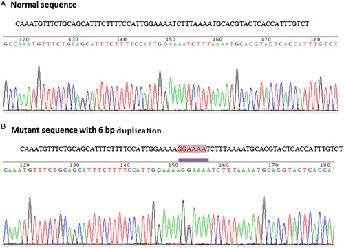 Figure 3. Chromatogram pictures of FLT3-ITD mutation.