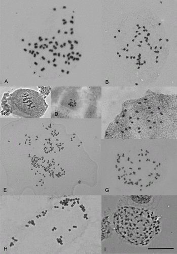 Figure 2  Chromosomes of New Zealand vascular plants. A, Senecio aff. glomeratus, 2n=60. B, Myosotis laeta, 2n=46. C, Drosera hookeri, n=16II. D, Drosera stenopetala, 2n=16. E, Acrothamnus colensoi, 2n=146. F, Gaultheria paniculata, 2n=22. G, Geranium (c) (CHR 546319; Von), 2n=52. H, Selliera microphylla, 2n=56. I, Juncus holoschoenus var. holoschoenus, 2n=106. Scale bar = 10 µm.