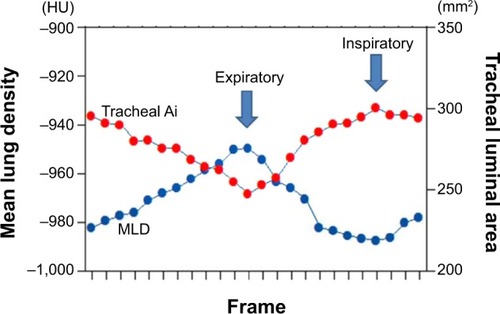 Figure 5 Continuous changes in Ai and MLD. It is obvious that the two time curves change almost simultaneously.