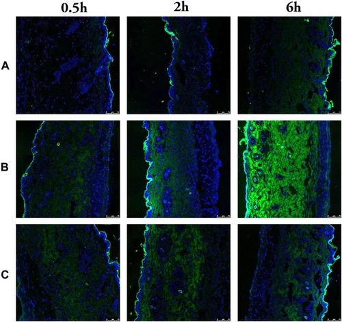 Figure 8 Laser scanning confocal micrograph of the mice skin treated with FITC-S (A), FITC-ASI-NEs (B) and FITC-ASI-NBGs (C) at 30 min, 2 h and 6 h.Abbreviations: FITC-S, FITC aq. solution; FITC-ASI-NEs, FITC-asiaticoside-loaded nanoemulsions; FITC-ASI-NBGs, FITC-asiaticoside-loaded nanoemulsions-based gels.