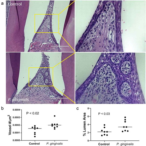 Figure 1. P. gingivalis-induced changes in rat interdental papillae. (a) Representative H & E stained tissue sections from sham control and P. gingivalis inoculated animals. Panels to the right of each image are magnified images of the boxed region. Scale bars = 200 μm. (b) Subgingival microvascular density expressed as vessel number/tissue area (μm2), and (c) microvascular dilatation (total vessel lumen area/tissue area)