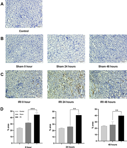 Figure 1 The expression of PD-1 in kidney tissue of mice. The IHC of PD-1 was shown in control groups (A), sham groups (B) and IRI groups (C). Quantification is represented in panel (D). Data are expressed as mean ± standard deviation. Difference between IRI group and sham group was made using unpaired Student’s t-test for normally distributed data. Images, × 200; original scale bar, 100 μm. **p<0.01. ***p<0.001.