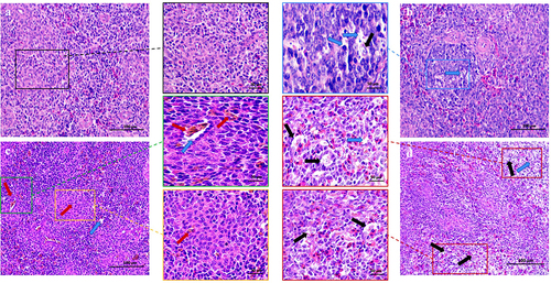 Figure 1. Histopathological changes of chicken spleen tissues (200x). (n = 3). Experimental groups including (A) Control group (B) MS-infection 3 dpi group (C) MS-infection 6 dpi group (D) MS-infection 12 dpi group. Black arrows represent spleen tissue losing its compact arrangement with increased infiltration of inflammatory cells. Green arrows represent lymphocyte infiltration. Red arrows represent necrotic fragments of lymphocytes. Yellow arrows represent bleeding.